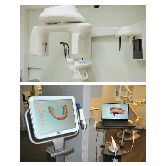 Dental Implants
